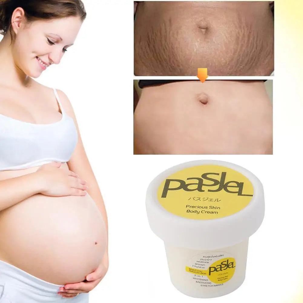 Stretch Mark Repair Cream